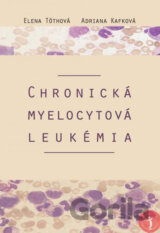 Chronická myelocytová leukémia