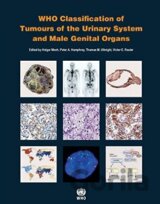 WHO Classification of Tumours of the Urinary System and Male Genital Organs