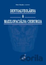 Dentoalveolárna a maxilofaciálna chirurgia