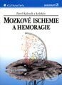 Kniha: Mozkové ischemie a hemoragie (Pavel Kalvach a kolektív). Grada Kniha: Mozkové ischemie a hemoragie (Pavel Kalvach a kolektív). Grada