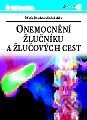 Kniha: Onemocnění žlučníku a žlučových cest (Marie Brodanová a kolektív). Grada Kniha: Onemocnění žlučníku a žlučových cest (Marie Brodanová a kolektív). Grada