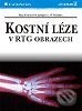 Kniha: Kostní léze v rentgenovém obraze (Klaus Bohndorf). Grada Kniha: Kostní léze v rentgenovém obraze (Klaus Bohndorf). Grada