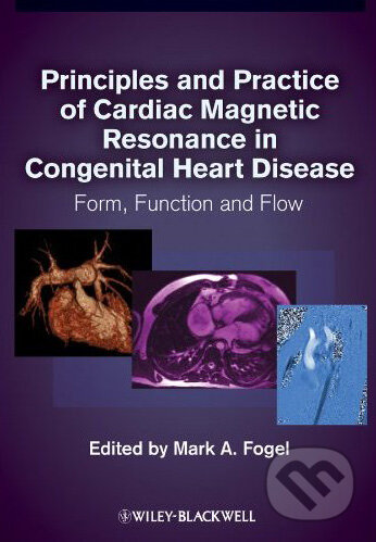Kniha: Principles and Practice of Cardiac Magnetic Resonance in Congenital Heart Disease (Mark A. Fogel). Wiley-Blackwell, 2010 Kniha: Principles and Practice of Cardiac Magnetic Resonance in Congenital Heart Disease (Mark A. Fogel). Wiley-Blackwell, 2010