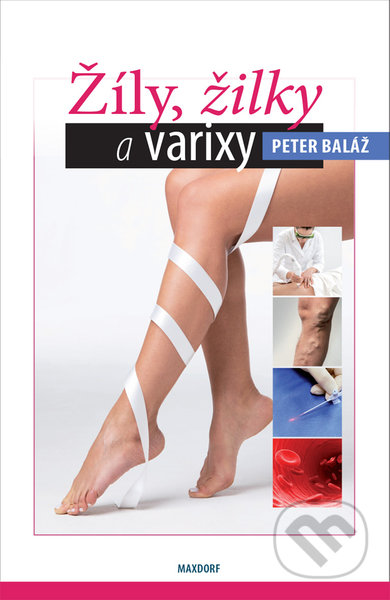 Kniha: Žíly, žilky a varixy (Peter Baláž). Maxdorf, 2021 Kniha: Žíly, žilky a varixy (Peter Baláž). Maxdorf, 2021