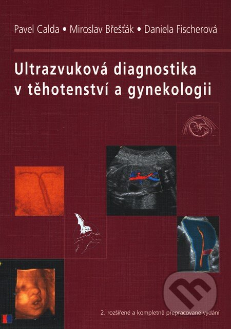 Kniha: Ultrazvuková diagnostika v těhotenství a gynekologii (Pavel Calda a kolektív). Aprofema, 2010 Kniha: Ultrazvuková diagnostika v těhotenství a gynekologii (Pavel Calda a kolektív). Aprofema, 2010