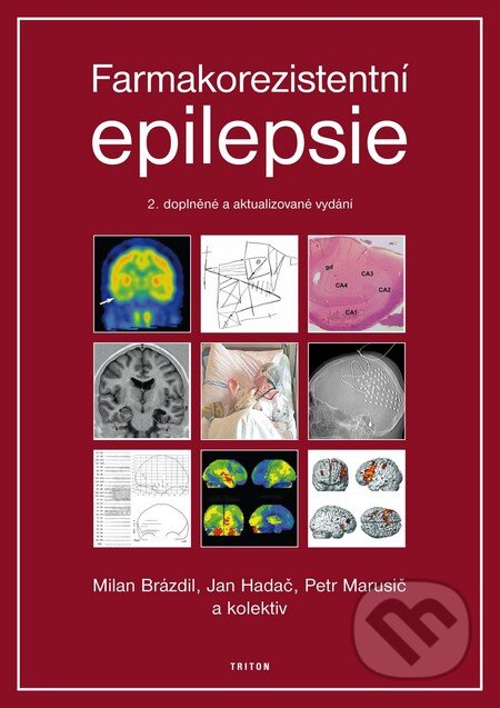Kniha: Farmakorezistentní epilepsie (Jan Hadač, Milan Brázdil, Petr Marusič a kolektiv). Triton, 2011 Kniha: Farmakorezistentní epilepsie (Jan Hadač, Milan Brázdil, Petr Marusič a kolektiv). Triton, 2011