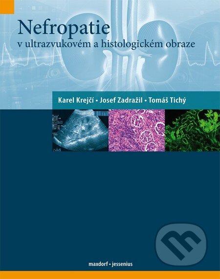 Kniha: Nefropatie v ultrazvukovém a histologickém obraze (Josef Zadražil, Karel Krejčí a Tomáš Tichý). Maxdorf, 2011 Kniha: Nefropatie v ultrazvukovém a histologickém obraze (Josef Zadražil, Karel Krejčí a Tomáš Tichý). Maxdorf, 2011