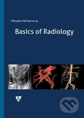 Kniha: Basics of Radiology (Miroslav Heřman). Univerzita Palackého v Olomouci, 2021 Kniha: Basics of Radiology (Miroslav Heřman). Univerzita Palackého v Olomouci, 2021