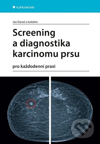 Kniha: Screening a diagnostika karcinomu prsu (Jan Daneš). Grada, 2021 Kniha: Screening a diagnostika karcinomu prsu (Jan Daneš). Grada, 2021