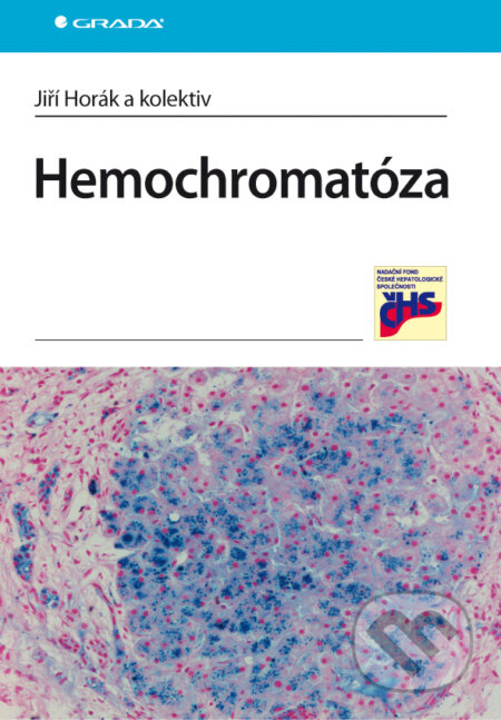 E-kniha: Hemochromatóza (Jiří Horák a kolektiv). Grada, 2010 E-kniha: Hemochromatóza (Jiří Horák a kolektiv). Grada, 2010