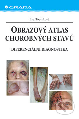 E-kniha: Obrazový atlas chorobných stavů (Eva Topinková). Grada, 2006 E-kniha: Obrazový atlas chorobných stavů (Eva Topinková). Grada, 2006