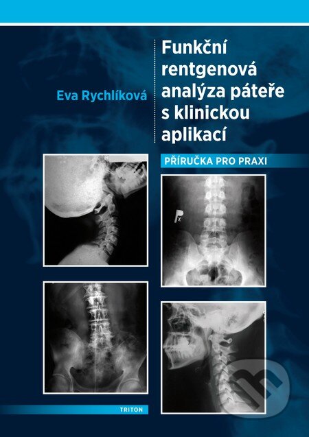 Kniha: Funkční rentgenová analýza páteře s klinickou aplikací (Eva Rychlíková). Triton, 2012 Kniha: Funkční rentgenová analýza páteře s klinickou aplikací (Eva Rychlíková). Triton, 2012