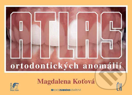 Kniha: Atlas ortodontických anomálií (Magdalena Koťová). Česká stomatologická komora Kniha: Atlas ortodontických anomálií (Magdalena Koťová). Česká stomatologická komora