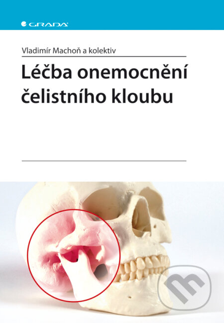 E-kniha: Léčba onemocnění čelistního kloubu (Vladimír Machoň a kolektiv). Grada, 2008 E-kniha: Léčba onemocnění čelistního kloubu (Vladimír Machoň a kolektiv). Grada, 2008