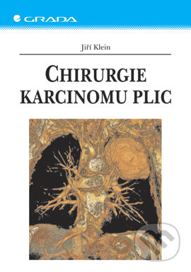 E-kniha: Chirurgie karcinomu plic (Jiří Klein). Grada, 2006 E-kniha: Chirurgie karcinomu plic (Jiří Klein). Grada, 2006