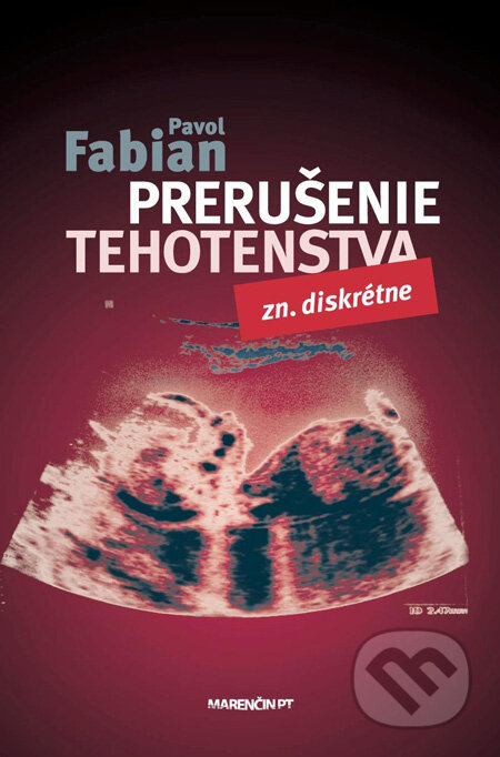 Kniha: Prerušenie tehotenstva (Pavol Fabian). Marenčin PT, 2012 Kniha: Prerušenie tehotenstva (Pavol Fabian). Marenčin PT, 2012