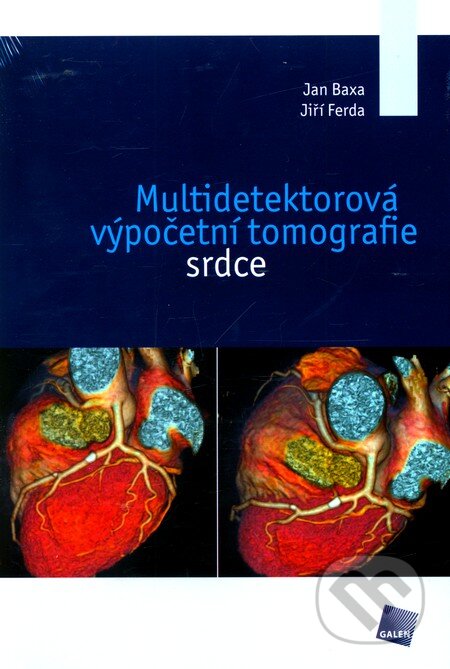 Kniha: Multidetektorová výpočetní tomografie srdce (Jan Baxa a Jiří Ferda). Galén, 2012 Kniha: Multidetektorová výpočetní tomografie srdce (Jan Baxa a Jiří Ferda). Galén, 2012
