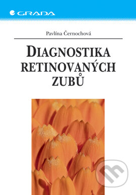 E-kniha: Diagnostika retinovaných zubů (Pavlína Černochová). Grada, 2006 E-kniha: Diagnostika retinovaných zubů (Pavlína Černochová). Grada, 2006