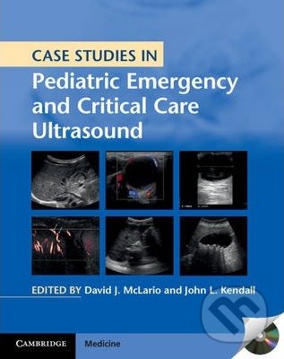 Kniha: Case Studies in Pediatric Emergency and Critical Care Ultrasound (David J. McLario a John L. Kendall). Cambridge University Press, 2013 Kniha: Case Studies in Pediatric Emergency and Critical Care Ultrasound (David J. McLario a John L. Kendall). Cambridge University Press, 2013