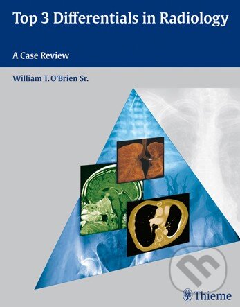 Kniha: Top 3 Differentials in Radiology (William T. O'Brien). Thieme, 2009 Kniha: Top 3 Differentials in Radiology (William T. O'Brien). Thieme, 2009