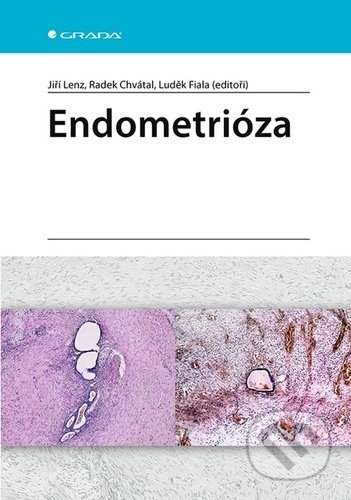 Kniha: Endometrióza (Jiří Lenz, Luděk Fiala a Radek Chvátal). Grada, 2021 Kniha: Endometrióza (Jiří Lenz, Luděk Fiala a Radek Chvátal). Grada, 2021
