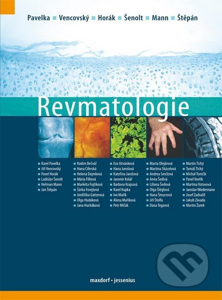 Kniha: Revmatologie (Jiří Vencovský, Karel Pavelka a kolektiv). Maxdorf, 2012 Kniha: Revmatologie (Jiří Vencovský, Karel Pavelka a kolektiv). Maxdorf, 2012