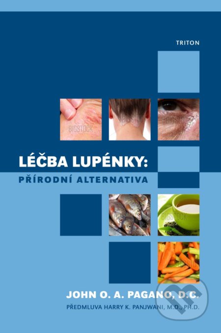 Kniha: Léčba lupénky (John O.A. Pagano). Triton, 2012 Kniha: Léčba lupénky (John O.A. Pagano). Triton, 2012