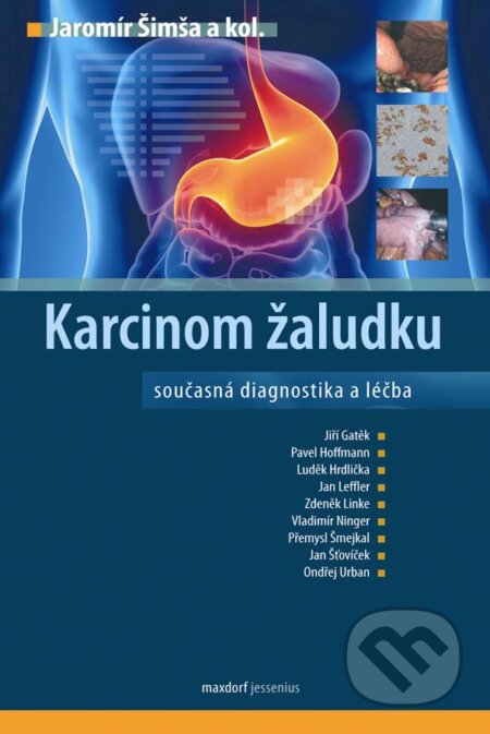 Kniha: Karcinom žaludku (Jaromír Šimša a kolektiv). Maxdorf, 2012 Kniha: Karcinom žaludku (Jaromír Šimša a kolektiv). Maxdorf, 2012