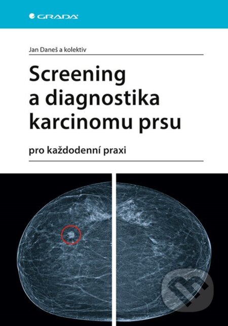 E-kniha: Screening a diagnostika karcinomu prsu (Jan Daneš). Grada, 2021 E-kniha: Screening a diagnostika karcinomu prsu (Jan Daneš). Grada, 2021