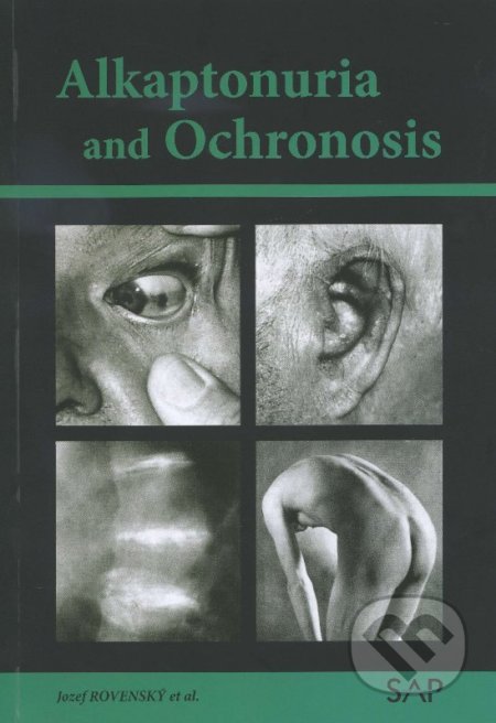 Kniha: Alkaptonuria and ochronosi (Jozef Rovenský). Slovak Academic Press, 2013 Kniha: Alkaptonuria and ochronosi (Jozef Rovenský). Slovak Academic Press, 2013