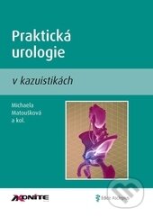 Kniha: Praktická urologie v kazuistikách (Michaela Matoušková). Axonite, 2013 Kniha: Praktická urologie v kazuistikách (Michaela Matoušková). Axonite, 2013