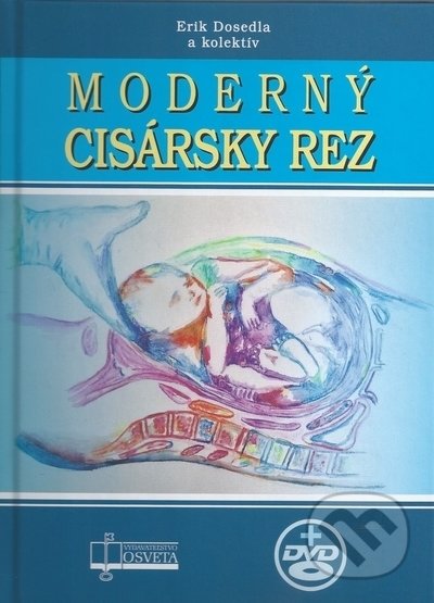 Kniha: Moderný cisársky rez (Erik Dosedla a kolektiv). Osveta, 2022 Kniha: Moderný cisársky rez (Erik Dosedla a kolektiv). Osveta, 2022