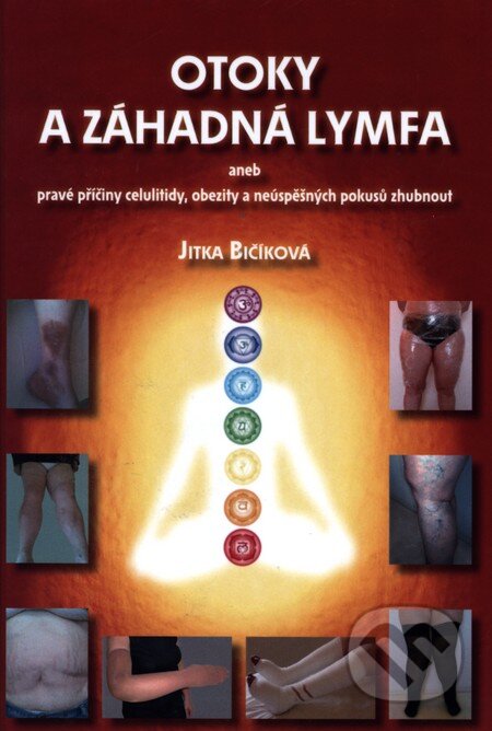 Kniha: Otoky a záhadná lymfa (Jitka Bičíková). Jitka Bičíková, 2013 Kniha: Otoky a záhadná lymfa (Jitka Bičíková). Jitka Bičíková, 2013