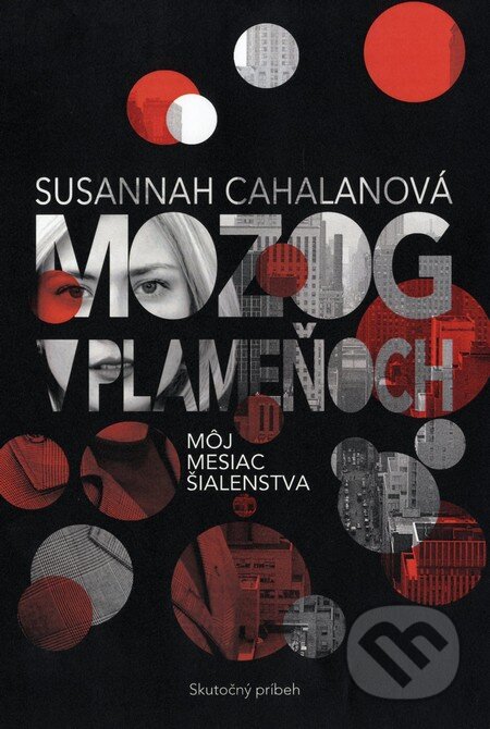 Kniha: Mozog v plameňoch (Susannah Cahalan). Fortuna Libri, 2013 Kniha: Mozog v plameňoch (Susannah Cahalan). Fortuna Libri, 2013