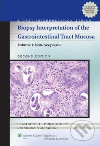 Kniha: Biopsy Interpretation of the Gastrointestinal Tract Mucosa (Volume 1) (Elizabeth A. Montgomery). Lippincott Williams & Wilkins, 2011 Kniha: Biopsy Interpretation of the Gastrointestinal Tract Mucosa (Volume 1) (Elizabeth A. Montgomery). Lippincott Williams & Wilkins, 2011