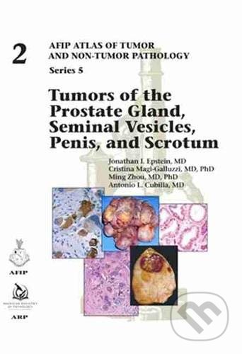 Kniha: Tumors of the Prostate Gland, Seminal Vesicles, Penis, and Scrotum (Antonio L. Cubilla, Cristina Magi-Galluzzi, Jonathan I. Epstein a Ming Zhou). American Registry of Pathology, 2020 Kniha: Tumors of the Prostate Gland, Seminal Vesicles, Penis, and Scrotum (Antonio L. Cubilla, Cristina Magi-Galluzzi, Jonathan I. Epstein a Ming Zhou). American Registry of Pathology, 2020