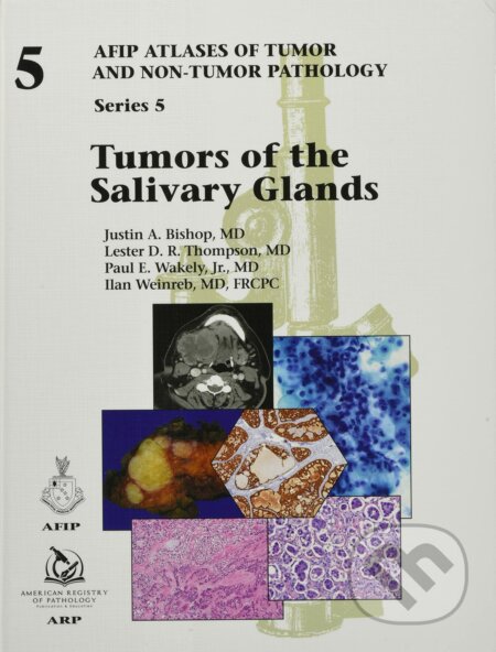 Kniha: Tumors of the Salivary Glands (Justin A. Bishop, Lester D.R. Thompson, Paul E. Wakely, Ilan Weinreb a jr.). American Registry of Pathology, 2021 Kniha: Tumors of the Salivary Glands (Justin A. Bishop, Lester D.R. Thompson, Paul E. Wakely, Ilan Weinreb a jr.). American Registry of Pathology, 2021
