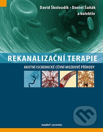 Kniha: Rekanalizační terapie (Daniel Šaňák, David Školoudík a kolektív). Maxdorf, 2013 Kniha: Rekanalizační terapie (Daniel Šaňák, David Školoudík a kolektív). Maxdorf, 2013