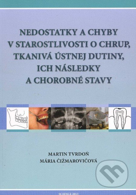 Nedostatky a chyby v starostlivosti o chrup, tkanivá ústnej dutiny, ich následky a chorobné stavy - Martin Tvrdoň, Mária Čižmarovičová, Science, 2013