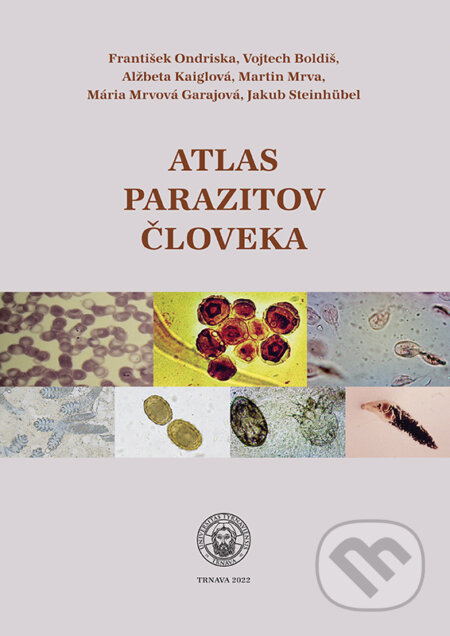 Kniha: Atlas parazitov človeka (Alžbeta Kaiglová, František Ondriska, Jakub Steinhübel, Mária Mrvová Gajarová, Martin Mrva a Vojtech Boldiš). Typi Universitatis Tyrnaviensis, 2022 Kniha: Atlas parazitov človeka (Alžbeta Kaiglová, František Ondriska, Jakub Steinhübel, Mária Mrvová Gajarová, Martin Mrva a Vojtech Boldiš). Typi Universitatis Tyrnaviensis, 2022