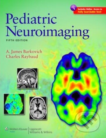 Kniha: Pediatric Neuroimaging (A. James Barkovich a Charles Raybaud). Lippincott Williams & Wilkins, 2011 Kniha: Pediatric Neuroimaging (A. James Barkovich a Charles Raybaud). Lippincott Williams & Wilkins, 2011