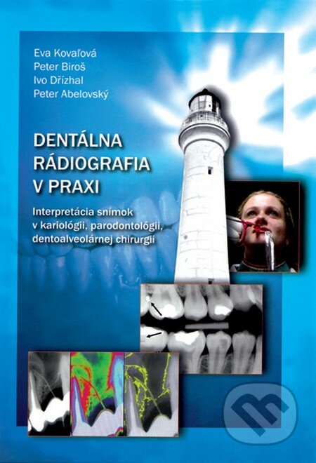 Kniha: Dentálna rádiografia v praxi (Eva Kovaľová, Ivo Dřízhal, Peter Abelovský a Peter Biroš). Akcent Print Kniha: Dentálna rádiografia v praxi (Eva Kovaľová, Ivo Dřízhal, Peter Abelovský a Peter Biroš). Akcent Print