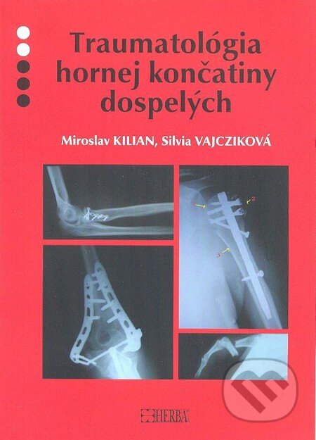 Kniha: Traumatológia hornej končatiny dospelých (Miroslav Kilian a Silvia Vajcziková). Herba, 2012 Kniha: Traumatológia hornej končatiny dospelých (Miroslav Kilian a Silvia Vajcziková). Herba, 2012