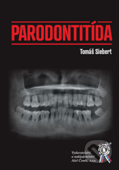 Kniha: Parodontitída (Tomáš Siebert). Aleš Čeněk, 2022 Kniha: Parodontitída (Tomáš Siebert). Aleš Čeněk, 2022