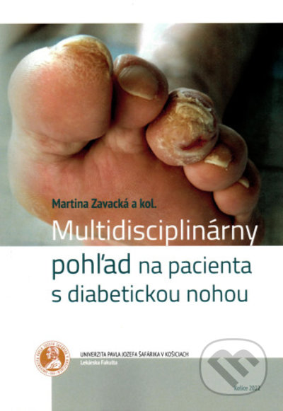 Kniha: Multidisciplinárny pohľad na pacienta s diabetickou nohou (Martina Zavacka). Univerzita Pavla Jozefa Šafárika v Košiciach, 2022 Kniha: Multidisciplinárny pohľad na pacienta s diabetickou nohou (Martina Zavacka). Univerzita Pavla Jozefa Šafárika v Košiciach, 2022