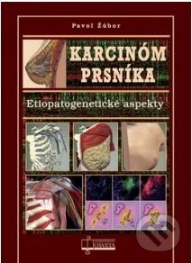 Kniha: Karcinóm prsníka (Pavol Žúbor). Osveta, 2014 Kniha: Karcinóm prsníka (Pavol Žúbor). Osveta, 2014