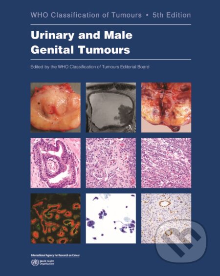 Urinary and Male Genital Tumours, World Health Organization, 2022