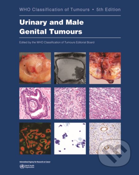 Kniha: Urinary and Male Genital Tumours (World Health Organization). World Health Organization, 2022 Kniha: Urinary and Male Genital Tumours (World Health Organization). World Health Organization, 2022