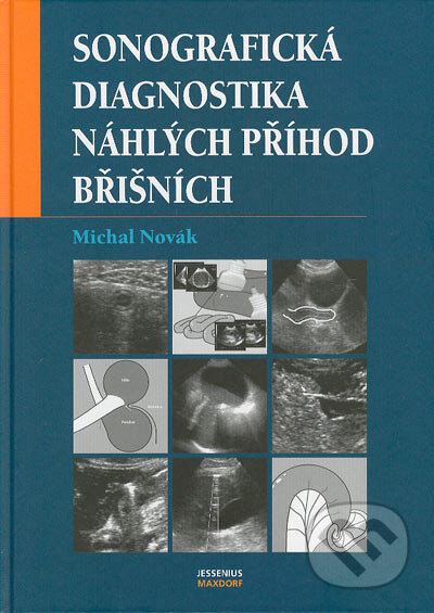 Sonografická diagnostika náhlých příhod břišních - Michal Novák, Maxdorf, 2004