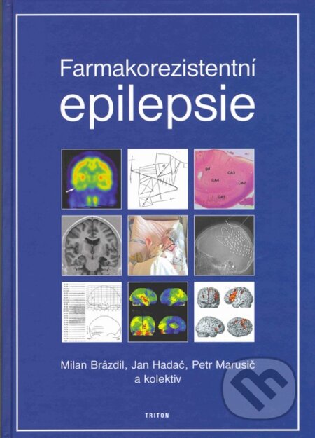 Kniha: Farmakorezistentní epilepsie (Jan Hadač, Milan Brázdil a Petr Marusič). Triton, 2004 Kniha: Farmakorezistentní epilepsie (Jan Hadač, Milan Brázdil a Petr Marusič). Triton, 2004